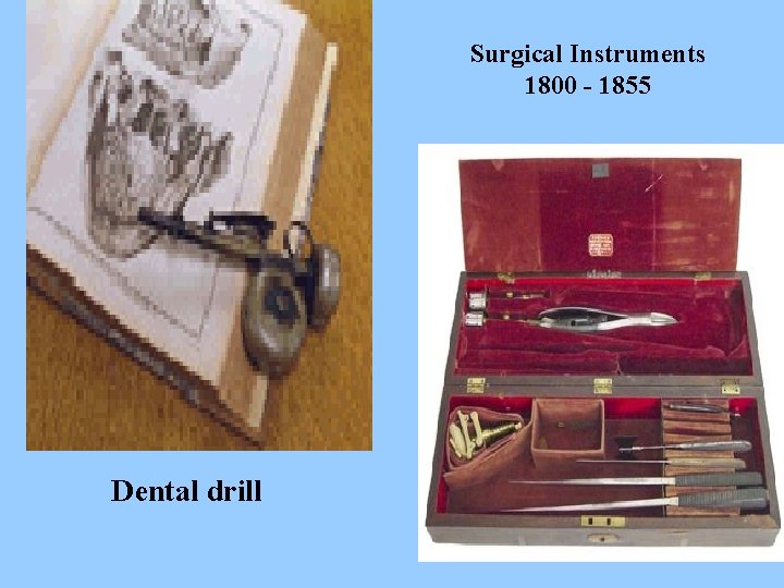 Surgical Instruments 1800 - 1855 Dental drill 