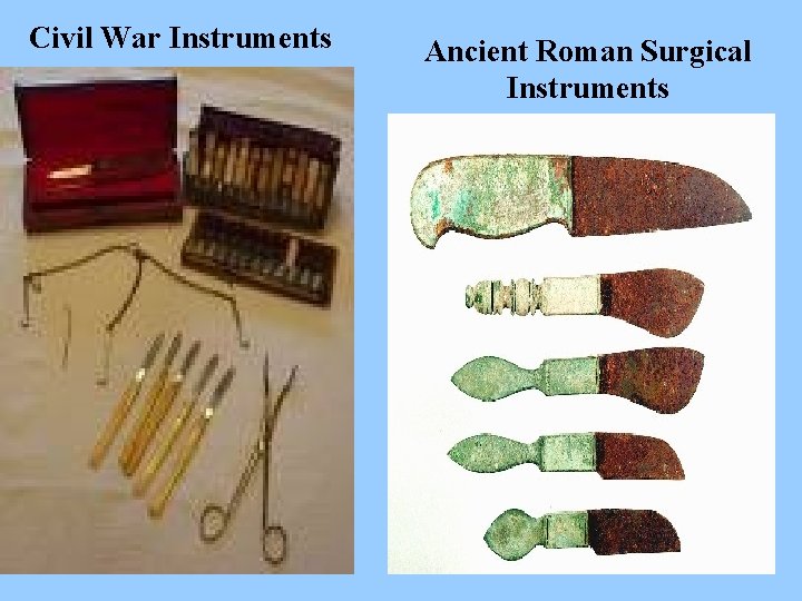 Civil War Instruments Ancient Roman Surgical Instruments 