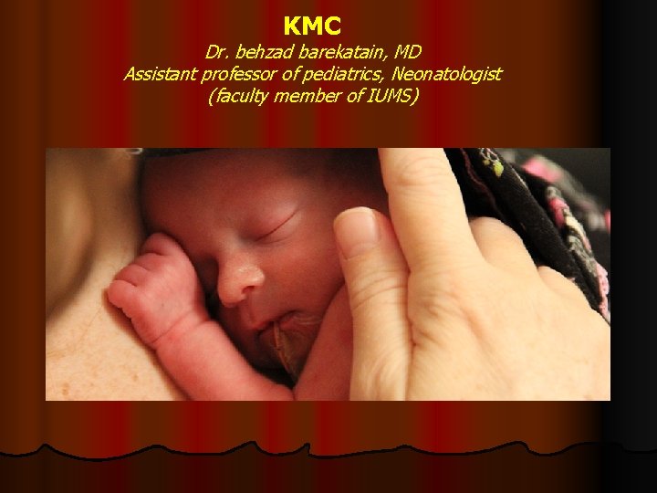 KMC Dr. behzad barekatain, MD Assistant professor of pediatrics, Neonatologist (faculty member of IUMS)