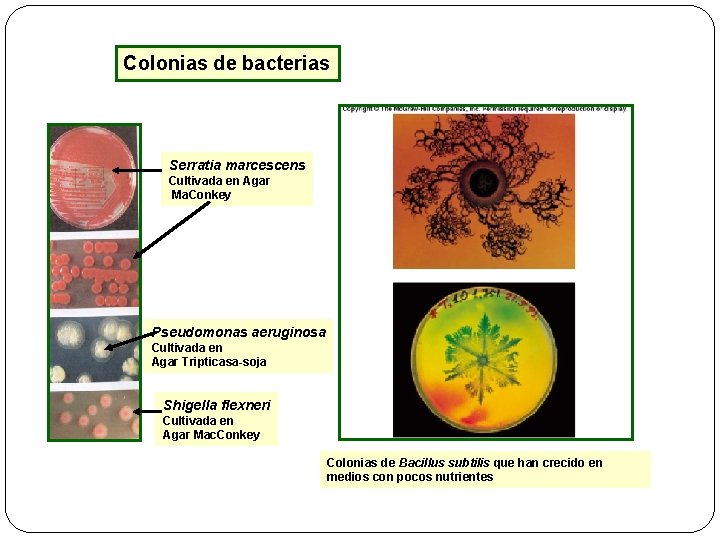 Colonias de bacterias Serratia marcescens Cultivada en Agar Ma. Conkey Pseudomonas aeruginosa Cultivada en