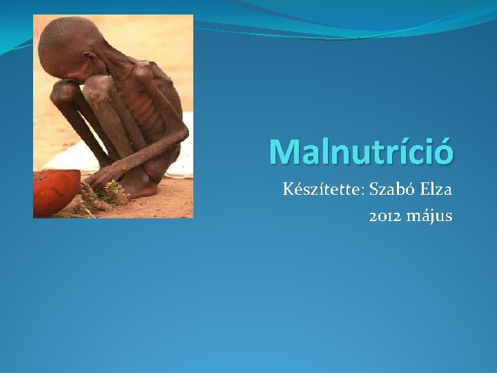 Malnutríció Készítette: Szabó Elza 2012 május 