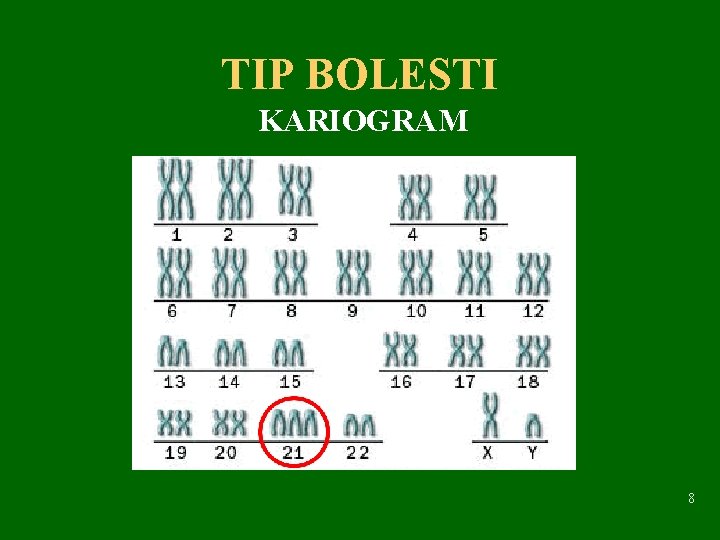 TIP BOLESTI KARIOGRAM 8 