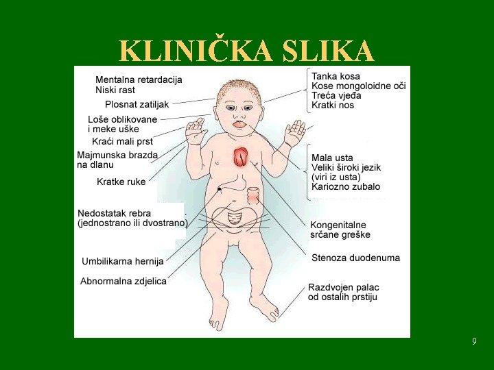 KLINIČKA SLIKA 9 