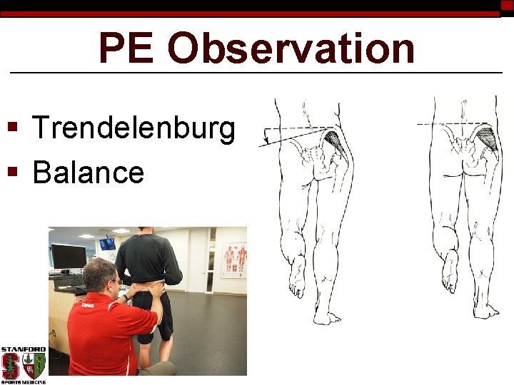 PE Observation § Trendelenburg § Balance 