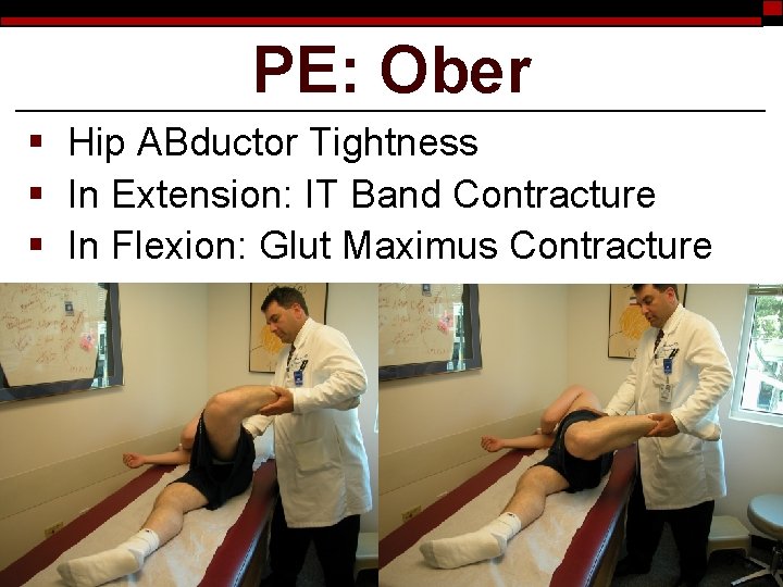 PE: Ober § Hip ABductor Tightness § In Extension: IT Band Contracture § In