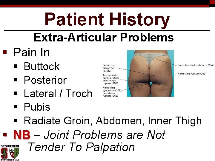 Patient History Extra-Articular Problems § Pain In § § § Buttock Posterior Lateral /