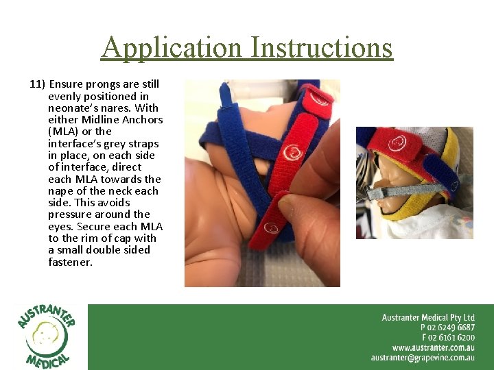 Application Instructions 11) Ensure prongs are still evenly positioned in neonate’s nares. With either