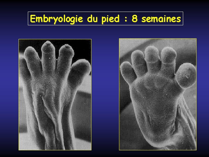 Embryologie du pied : 8 semaines 