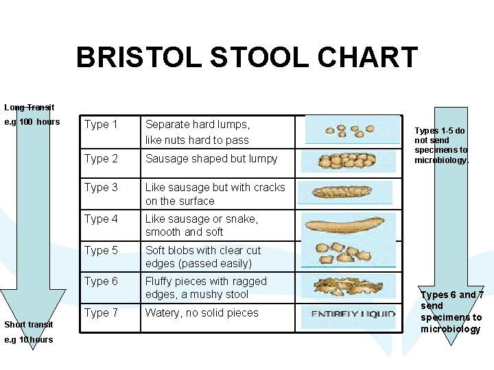 BRISTOL STOOL CHART Long Transit e. g 100 hours Type 1 Separate hard lumps,