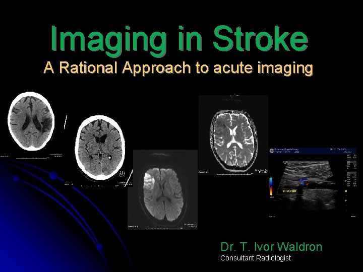 Imaging in Stroke A Rational Approach to acute imaging Dr. T. Ivor Waldron Consultant