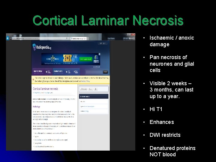 Cortical Laminar Necrosis • Ischaemic / anoxic damage • Pan necrosis of neurones and