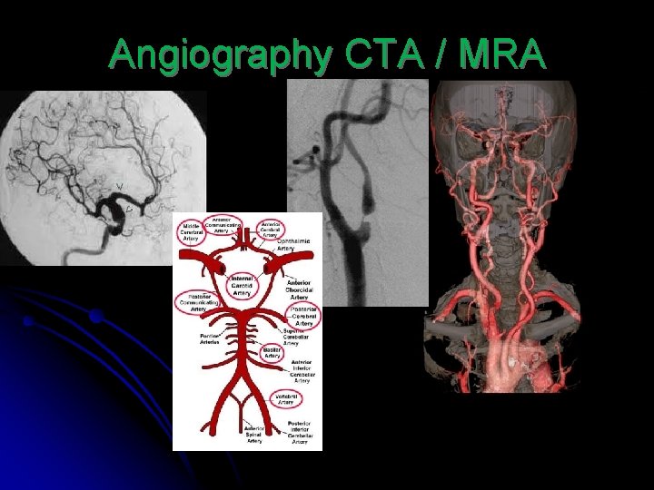 Angiography CTA / MRA 