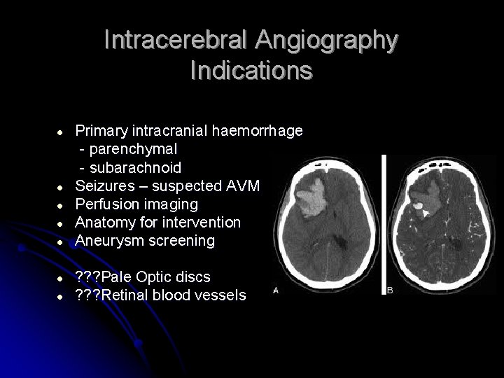 Intracerebral Angiography Indications ● ● Primary intracranial haemorrhage - parenchymal - subarachnoid Seizures –