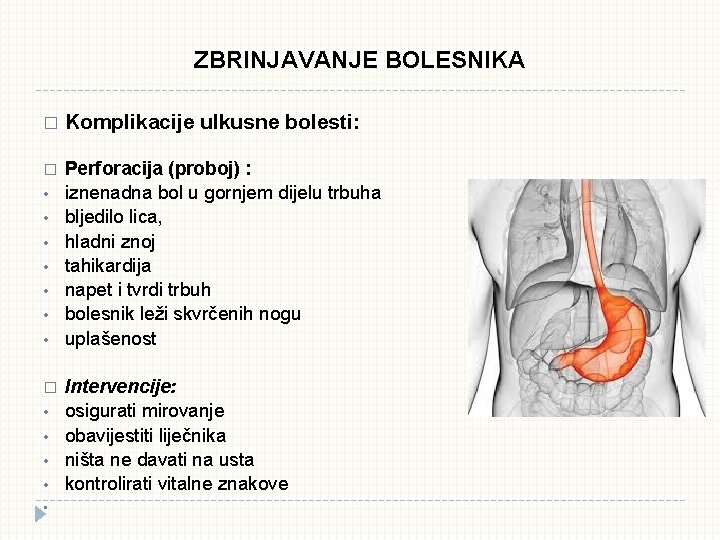 ZBRINJAVANJE BOLESNIKA � Komplikacije ulkusne bolesti: � Perforacija (proboj) : iznenadna bol u gornjem ZBRINJAVANJE BOLESNIKA � Komplikacije ulkusne bolesti: � Perforacija (proboj) : iznenadna bol u gornjem