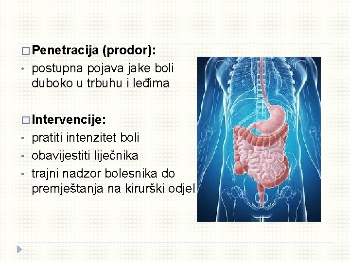 � Penetracija • (prodor): postupna pojava jake boli duboko u trbuhu i leđima �