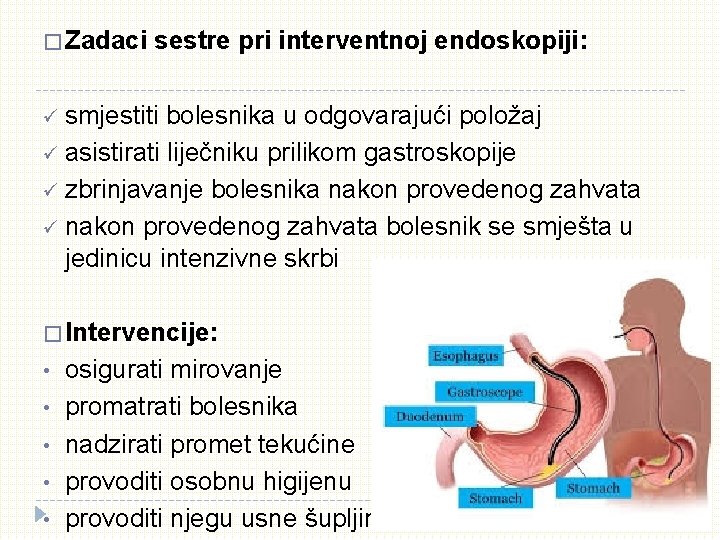 � Zadaci sestre pri interventnoj endoskopiji: ü smjestiti bolesnika u odgovarajući položaj ü asistirati