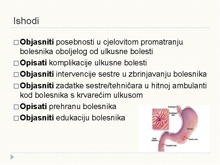 Ishodi � Objasniti posebnosti u cjelovitom promatranju bolesnika oboljelog od ulkusne bolesti � Opisati