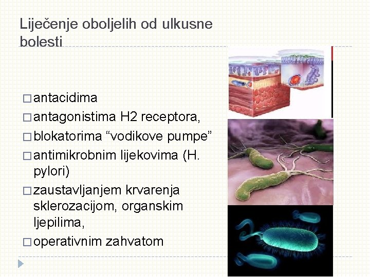 Liječenje oboljelih od ulkusne bolesti � antacidima � antagonistima H 2 receptora, � blokatorima