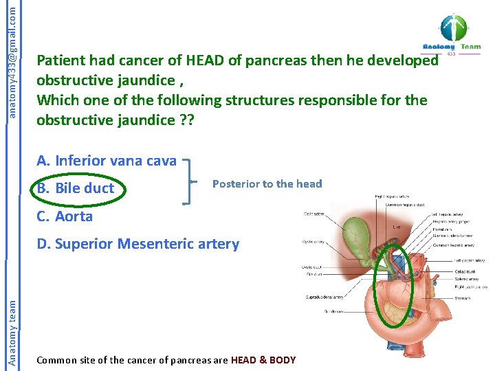 anatomy 433@gmail. com Patient had cancer of HEAD of pancreas then he developed obstructive