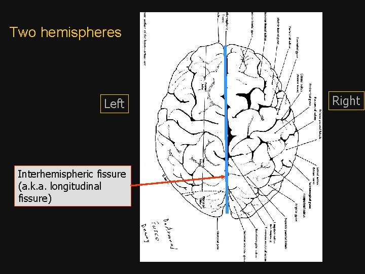 Two hemispheres Left Interhemispheric fissure (a. k. a. longitudinal fissure) Right 