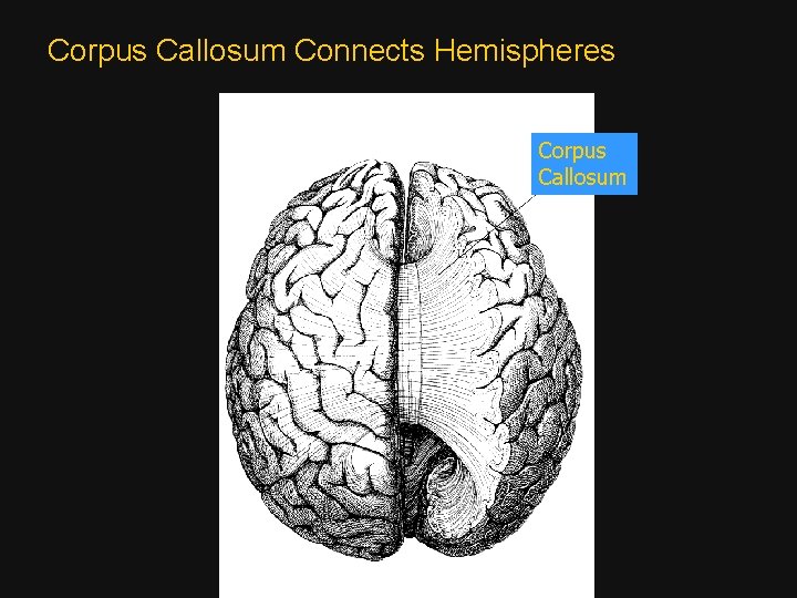 Corpus Callosum Connects Hemispheres Corpus Callosum 