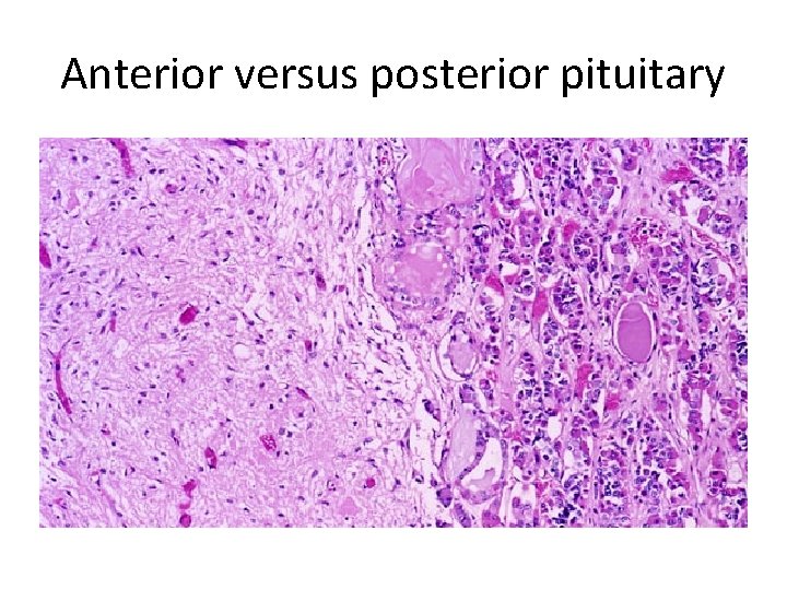 Anterior versus posterior pituitary 