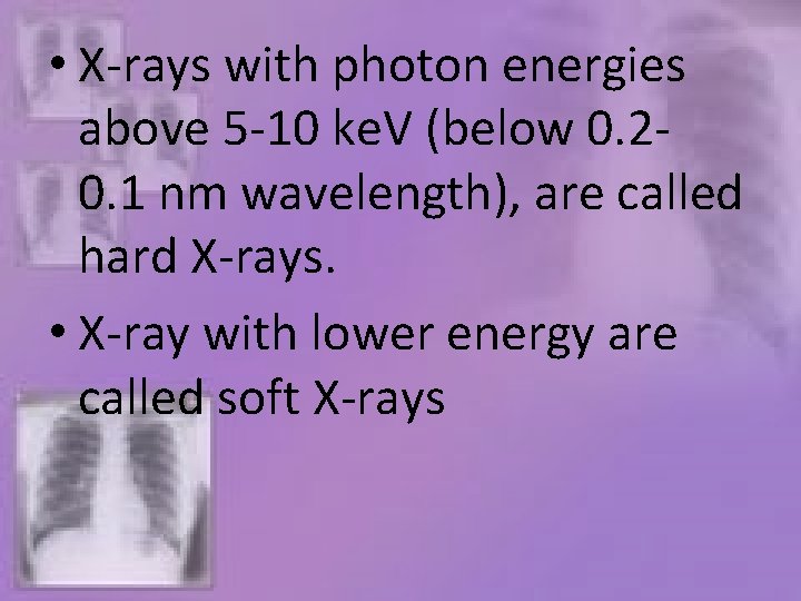  • X-rays with photon energies above 5 -10 ke. V (below 0. 20.