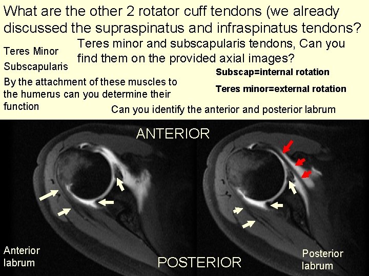 What are the other 2 rotator cuff tendons (we already discussed the supraspinatus and