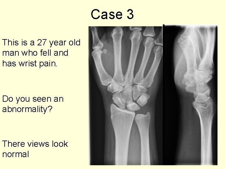 Case 3 This is a 27 year old man who fell and has wrist