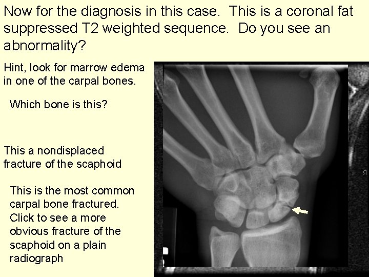 Now for the diagnosis in this case. This is a coronal fat suppressed T