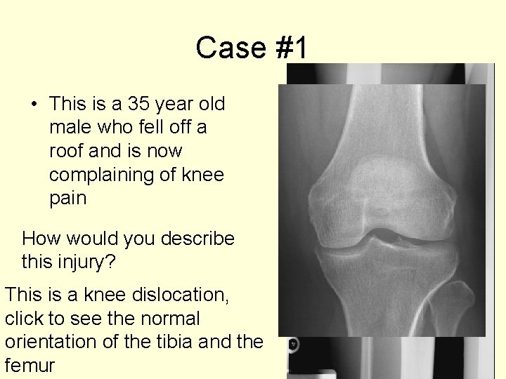 Case #1 • This is a 35 year old male who fell off a