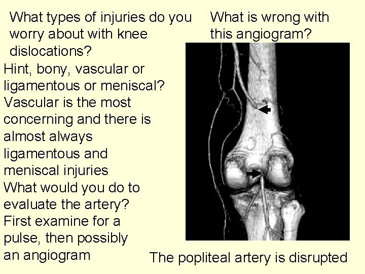 What types of injuries do you What is wrong with worry about with knee