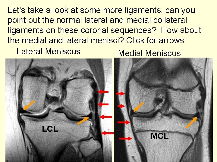 Let’s take a look at some more ligaments, can you point out the normal