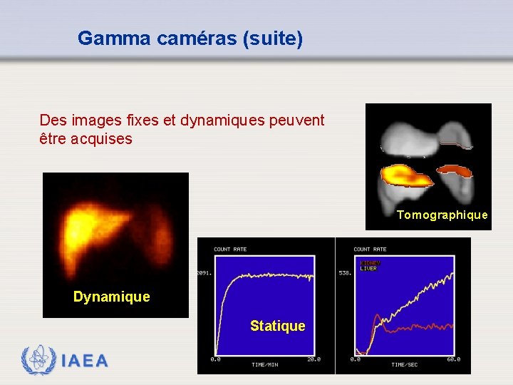 Gamma caméras (suite) Des images fixes et dynamiques peuvent être acquises Tomographique Dynamique Statique