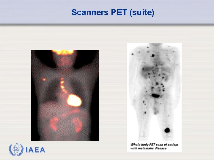 Scanners PET (suite) IAEA 