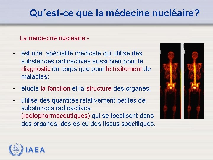Qu´est-ce que la médecine nucléaire? La médecine nucléaire: - • est une spécialité médicale