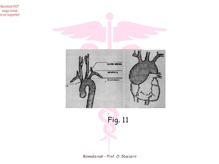 Fig. 11 Biomateriali - Prof. O. Sbaizero 