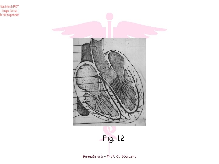 Fig. 12 Biomateriali - Prof. O. Sbaizero 