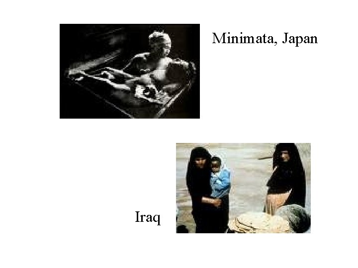 Minimata, Japan Iraq 