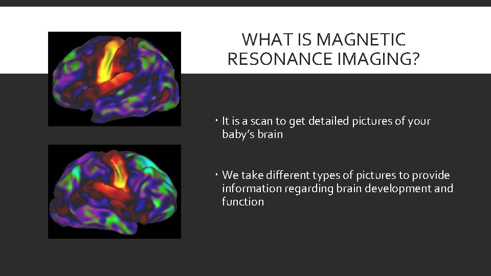 WHAT IS MAGNETIC RESONANCE IMAGING? It is a scan to get detailed pictures of