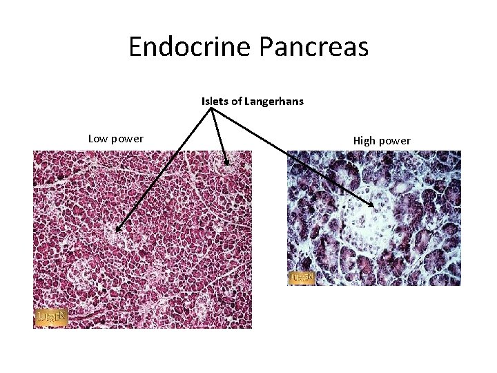 Endocrine Pancreas Islets of Langerhans Low power High power 