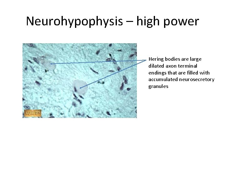 Neurohypophysis – high power Hering bodies are large dilated axon terminal endings that are