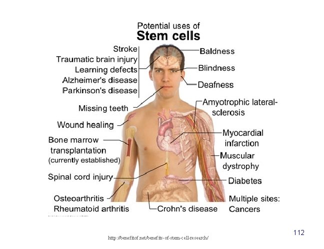 http: //benefitof. net/benefits-of-stem-cell-research/ 112 