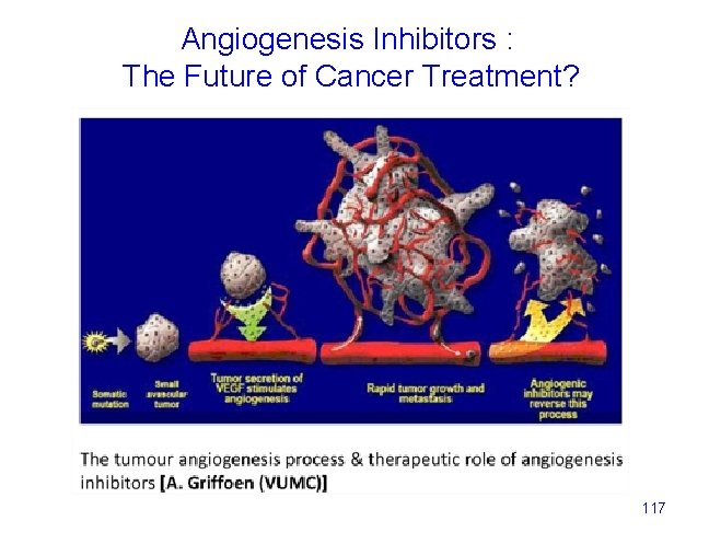 Angiogenesis Inhibitors : The Future of Cancer Treatment? 117 