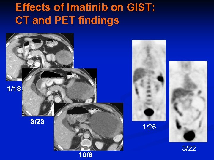 Effects of Imatinib on GIST: CT and PET findings 1/18 3/23 1/26 10/8 3/22