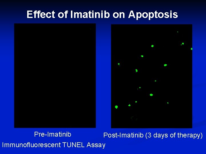 Effect of Imatinib on Apoptosis Pre-Imatinib Post-Imatinib (3 days of therapy) Immunofluorescent TUNEL Assay