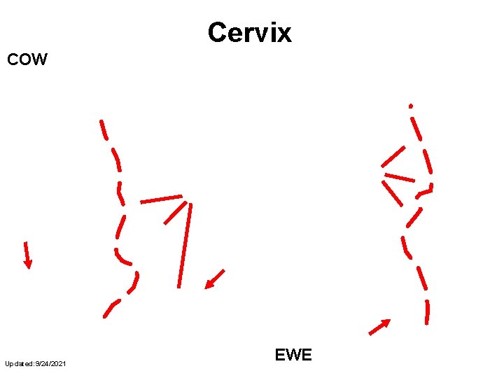 Cervix COW Internal Os Cervical Ring Fornix External Os Anterior Vagina Updated: 9/24/2021 EWE