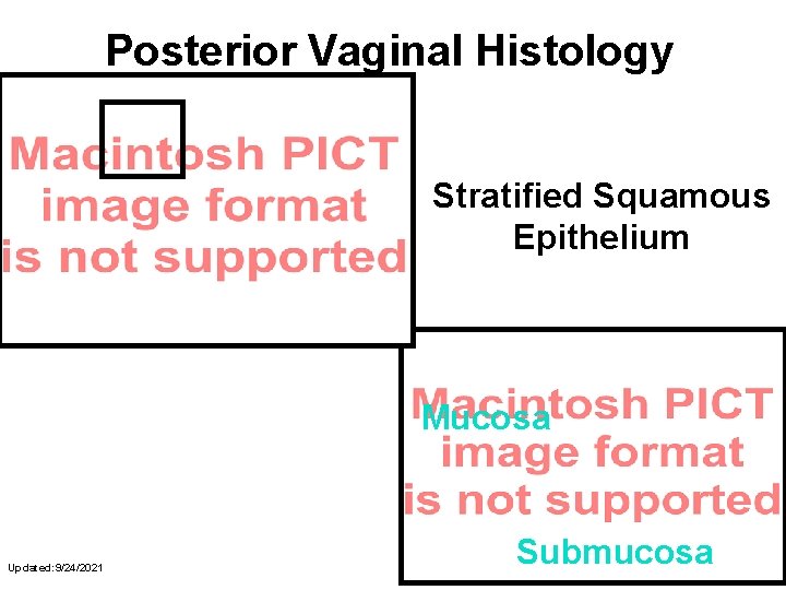 Posterior Vaginal Histology Stratified Squamous Epithelium Mucosa Updated: 9/24/2021 Submucosa 