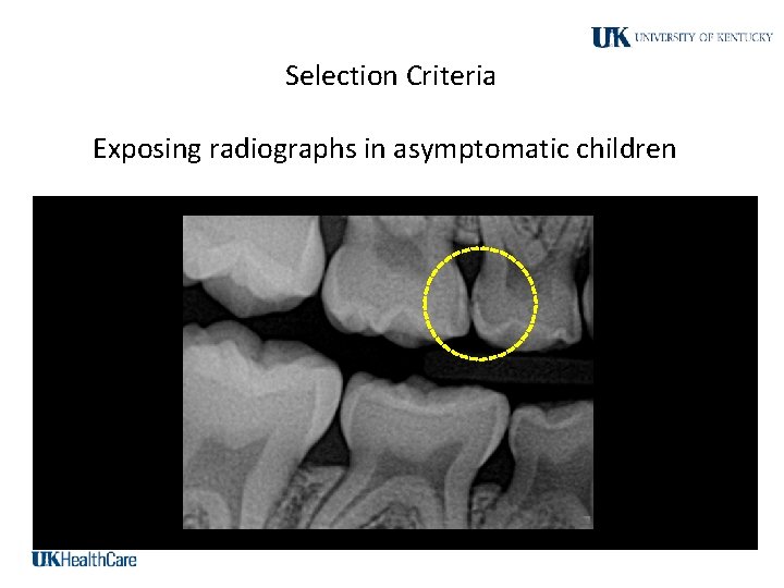 Selection Criteria Exposing radiographs in asymptomatic children 