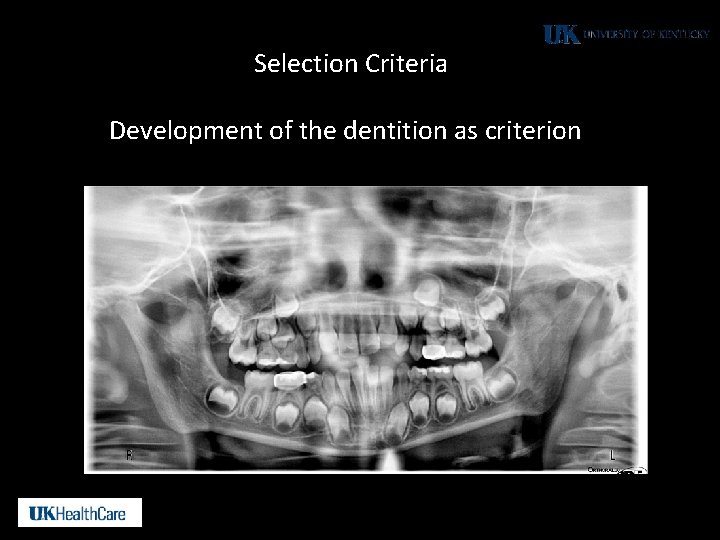 Selection Criteria Development of the dentition as criterion 